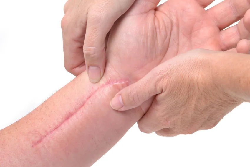 Wound & Scar Care